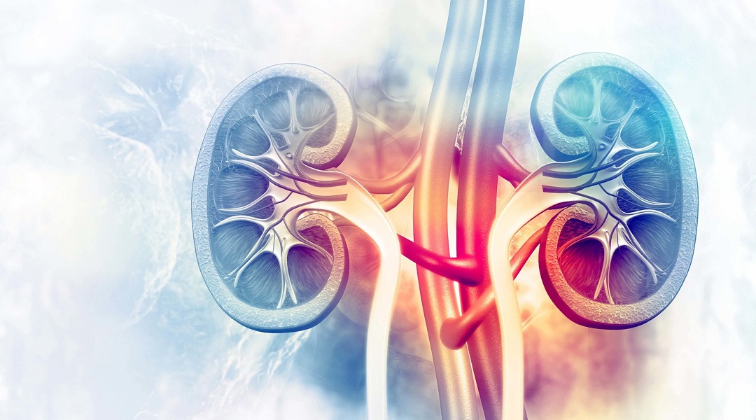 лікування урологічних захворювань у санаторії України ПОЛО-МЕДЛАЙФ